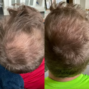 BODYWISE 🇺🇸 - No se trata solo de cabello. Se trata de cómo vuelves a sentirte.❤️